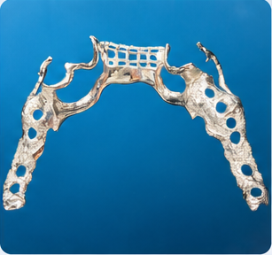 Metalowy element szkieletowy protezy na niebieskim tle.
